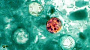 Parasite Outbreak Not Yet Seen in California